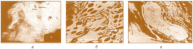 Мал. 7.10. Мацерали, мікроскопічно розпізнавані на шліфах кам'яного вугілля:[br] а – чистий вітриніт (збільшення – 250), б – вкраплення інертиніту (збільшення – 250), в – вкраплення ліптиніту (макроспора, збільшення – 140)
